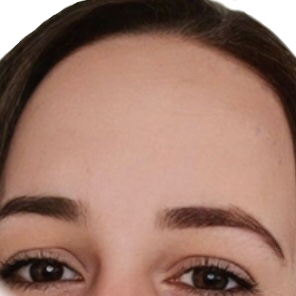 :forehead: