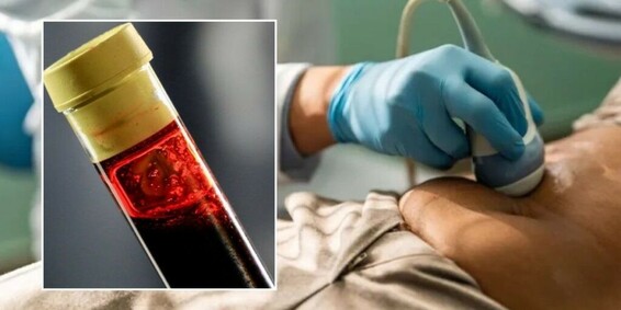 Supplement found to flush cancer-causing substance from body